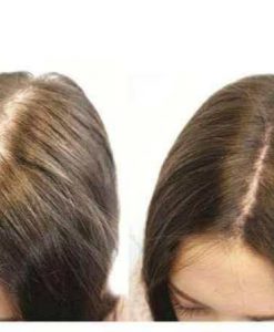 Alternative view of Bộ gội xả kích thích mọc tóc BIOTIN