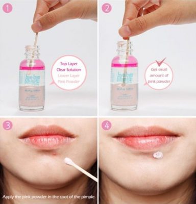 Chấm mụn byebye blemish